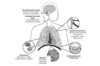 Активная дыхательная недостаточность