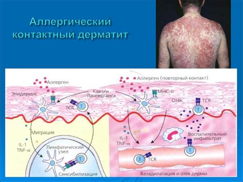 Аллергические реакции и зуд живота