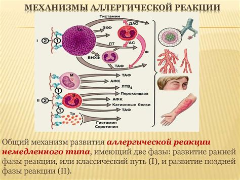 Аллергические реакции как основная причина залысин