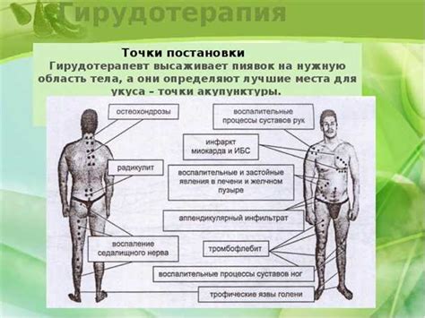 Альтернативные методы использования пиявок