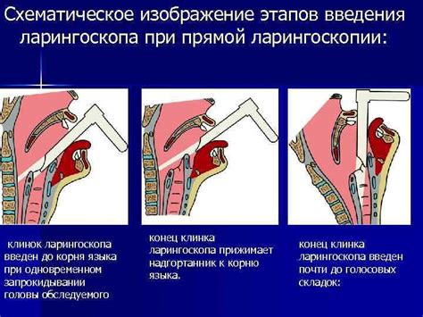 Альтернативные методы отключения голосового сопровождения