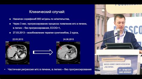 Анализ и обсуждение сложных случаев