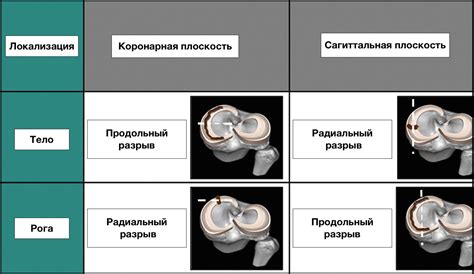 Анализ степени повреждения и удаление вилки