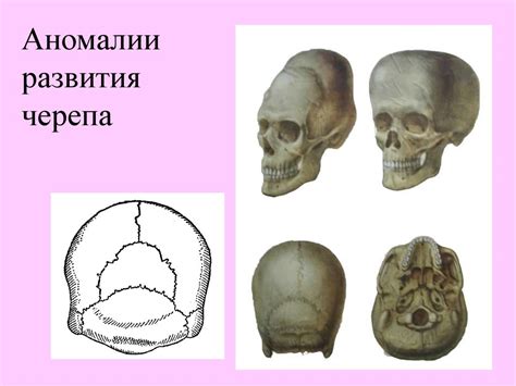 Аномалии костей и суставов свиньи: причины и последствия