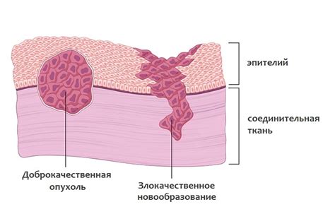 Аномальные образования и опухоли