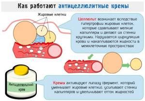 Антицеллюлитные кремы и гели: наиболее эффективные ингредиенты