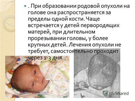 Асимптомы и признаки родовой опухоли