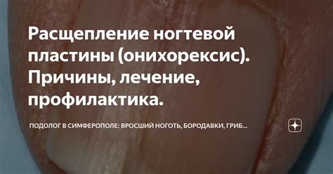 Атрофия ногтевой пластинки