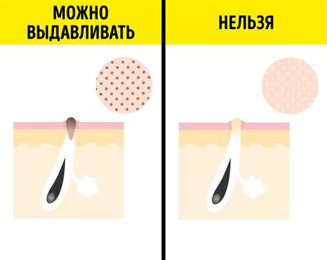 Безопасные методы предотвращения появления сальных нитей