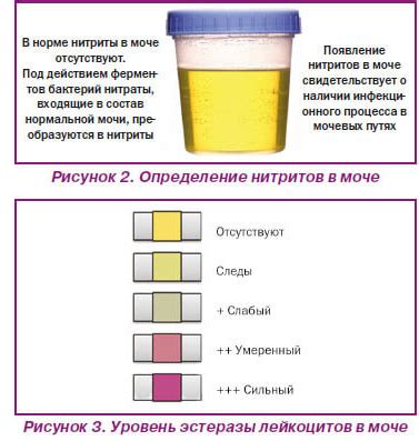 Белоснежная моча как признак здоровья