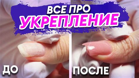 Бережное укрепление ногтевой пластины