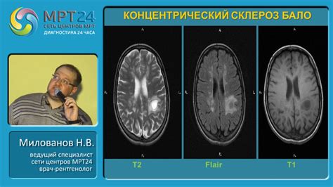 Биохимические изменения в мозге