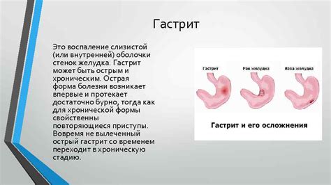 Болезни пищеварительной системы