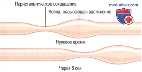 Больше движения - лучше перистальтика