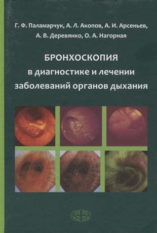 Бронхоскопия: роль метода в поиске и диагностике легочных заболеваний