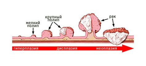 Быстрое возобновление роста полипа