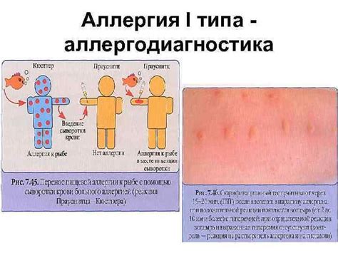 Быстрое устранение аллергических реакций