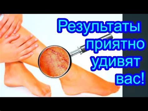 Быстрые и эффективные результаты