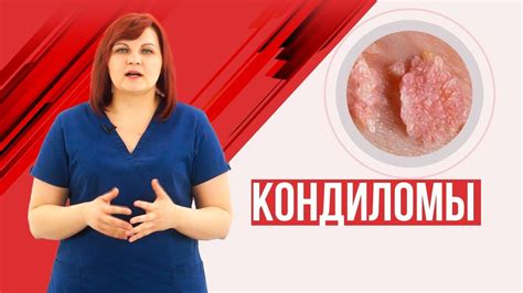 ВПЧ и мужское здоровье: потенциальные последствия