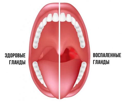 Важная роль гланд в организме