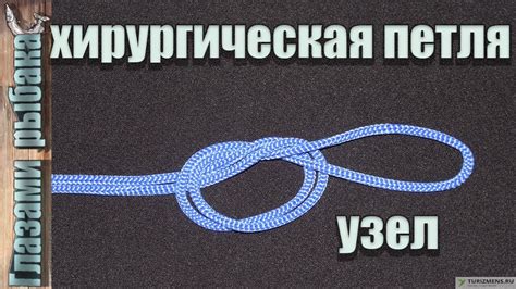 Важное правило: как завязать хирургический узел для рыбалки