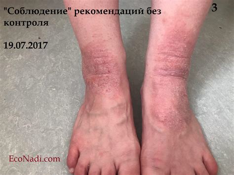 Важность ведения пищевого дневника