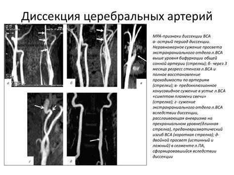 Важность правильного подхода в молодом возрасте