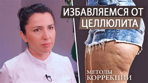 Важность физических нагрузок в борьбе с целлюлитом