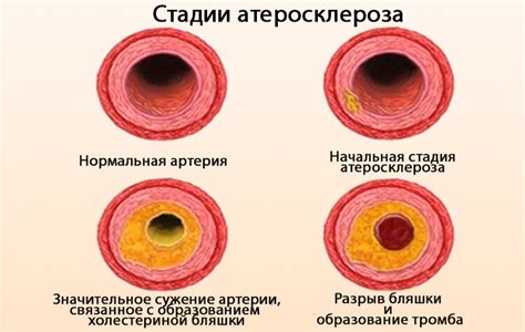 Варианты причин недостаточного давления: