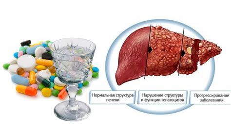 Взаимодействие лекарств с алкоголем