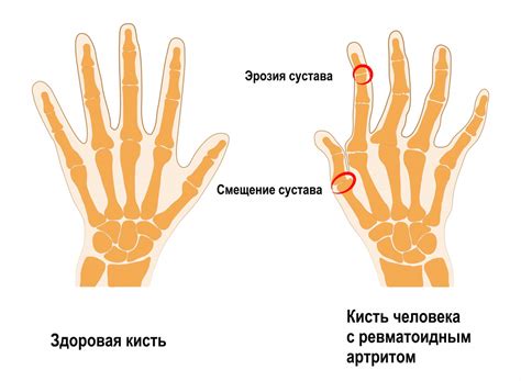 Виды пяти пальцев на руках