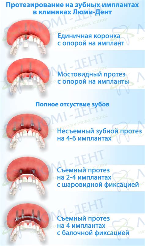 Визуальная проверка места имплантации