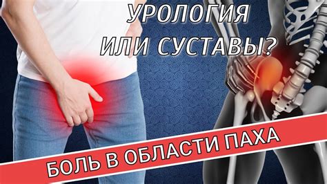 Влажность в области паха: основные проблемы