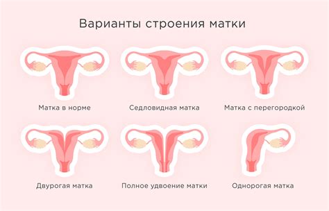 Влияние анатомии матки на позицию ребенка