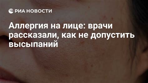 Влияние винограда на аллергию у взрослых: причины и симптомы