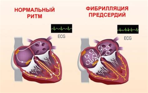 Влияние внешних факторов на исходы