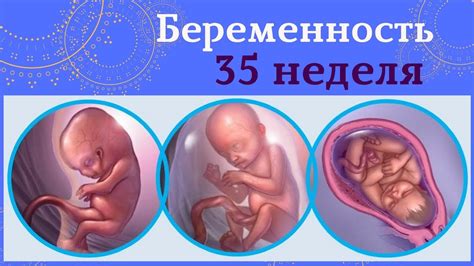 Влияние внешних факторов на появление икоты у плода на 35 неделе беременности