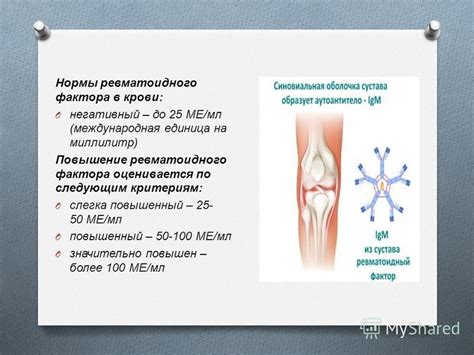 Влияние генетических факторов на повышение ревматоидного фактора