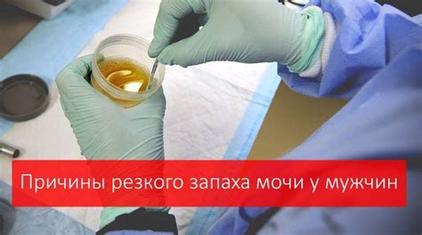 Влияние заболеваний мочевой системы на запах мочи у мужчин