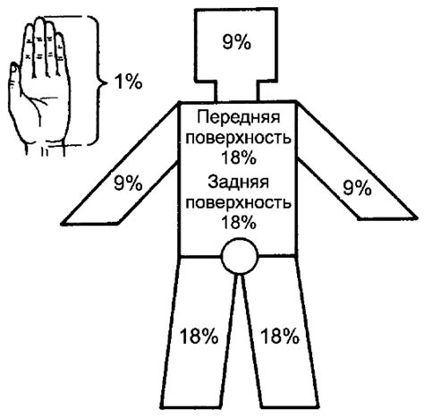 Влияние места и размера ожога на исцеление