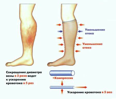 Влияние образа жизни на появление отеков ног и рук у женщин