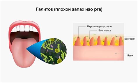 Влияние питания на запах изо рта у подростков