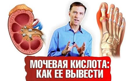 Влияние пищи на уровень мочевой кислоты