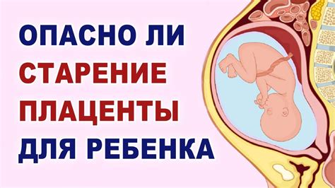 Влияние плаценты на положение ребенка