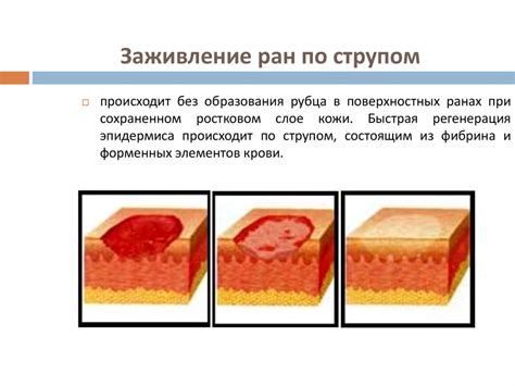 Влияние подсушивания на процесс заживления ран