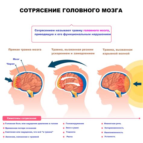 Влияние рентгеновского исследования на диагностику сотрясения головного мозга