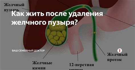 Влияние удаления желчного пузыря на жировую ткань