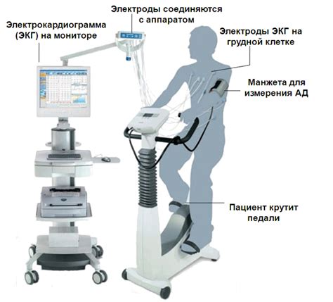 Влияние физической активности на результаты ЭКГ