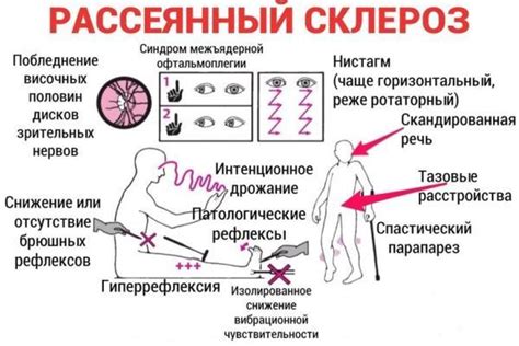 Внешние причины ослабления вестибулярного аппарата