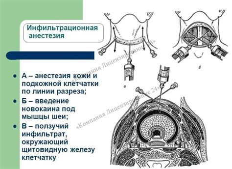 Внутрикостная анестезия